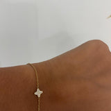 Camera Bracelet